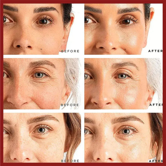 Retinol Faltenentferner Gesichtscreme Straffendes Lifting Anti Aging Verblassen Feiner Linien Feuchtigkeitsspendende Aufhellung Hautpflege Koreanische Kosmetik